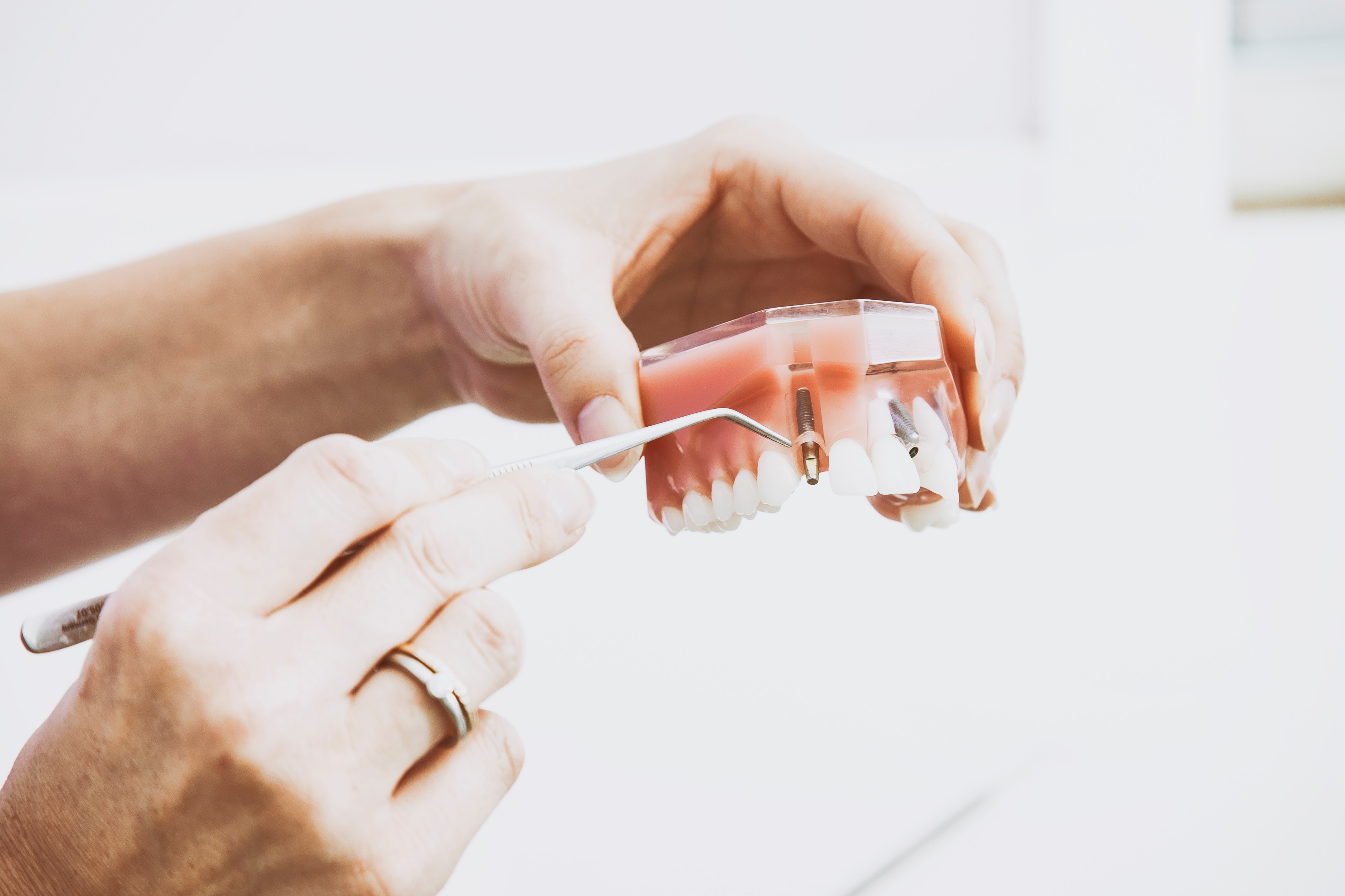 Cirug�a e implantologia bucal